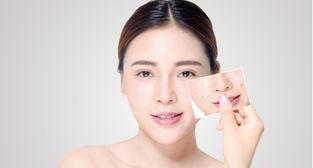 图片加载失败