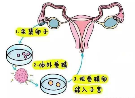 图片加载失败