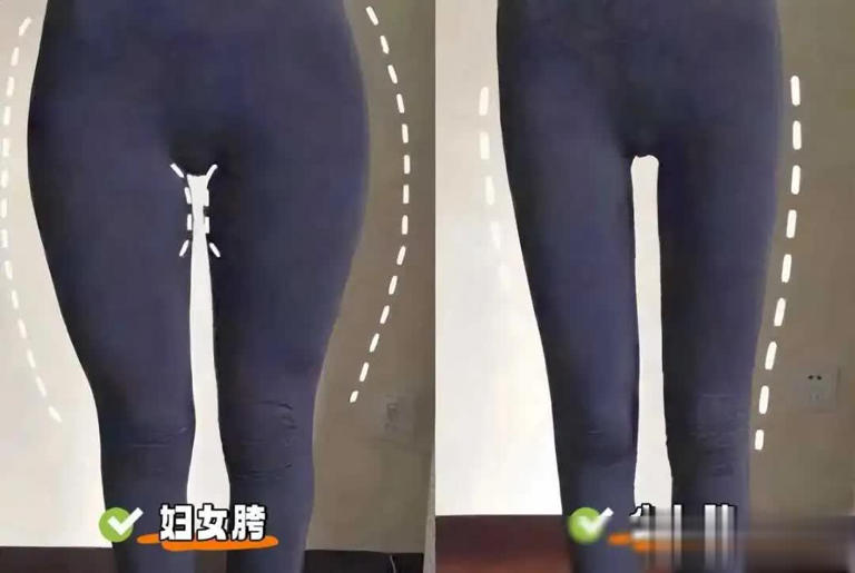 图片加载失败