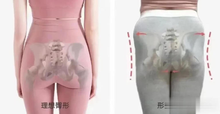 图片加载失败