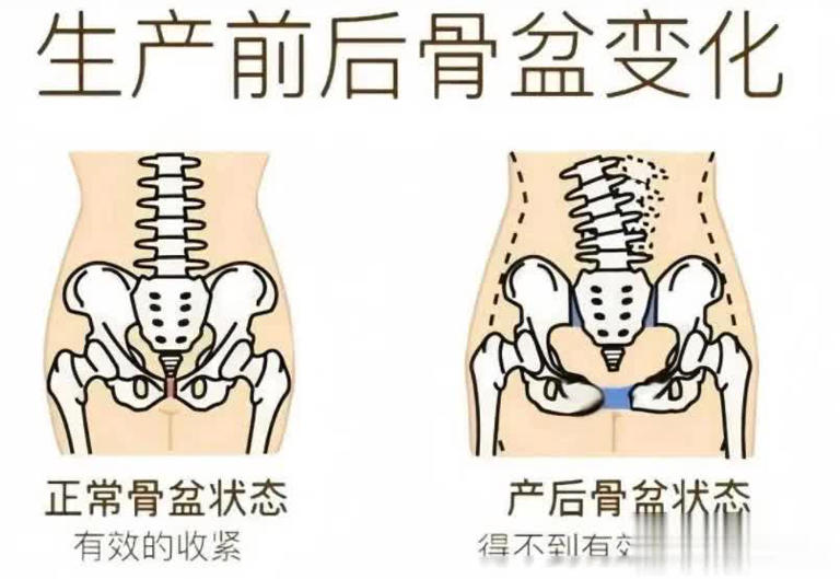 图片加载失败